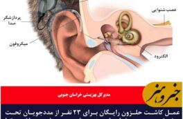 کاشت حلزون رایگان برای ۲۳ نفر از سوی وزارت بهداشت تا پایان سال در خراسان جنوبی